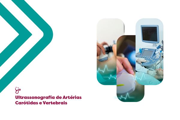 Ultrassonografia de Artérias Carótidas e Vertebrais: Domine a Avaliação Vascular